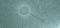 LC16-VCM1#5 EM micrograph